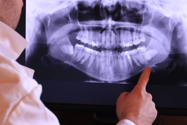 Best Emergency Denture Repair in Crozet, VA