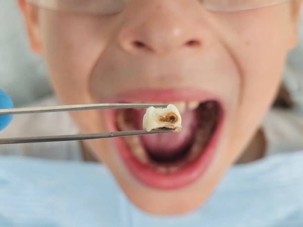 Best Cosmetic Emergency Dentistry in Crozet, VA